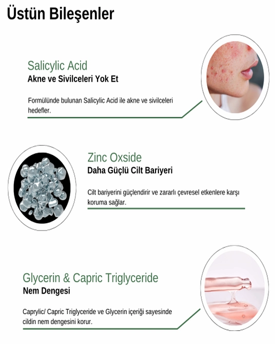 Sivilce Ve Akne Karşıtı Yüz Kremi